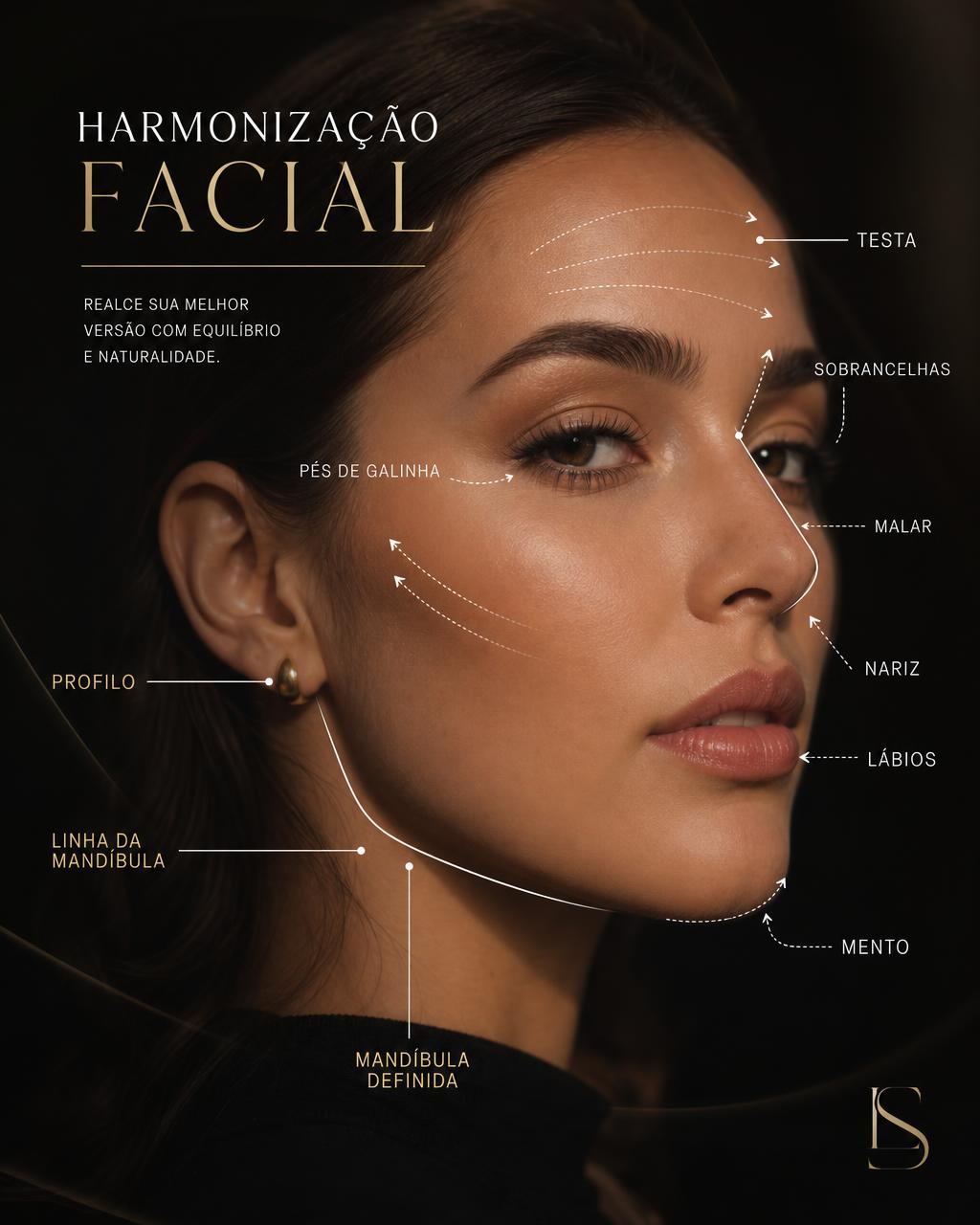 Vídeo em breve: Harmonização facial
